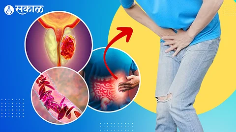 how to stop frequent urination naturally