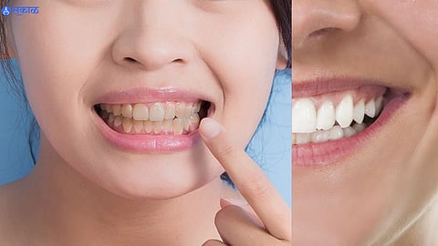 Clean Teeth Tips