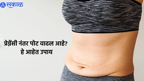 Belly Fat After Delivery