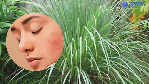 Lemongrass for Skin
