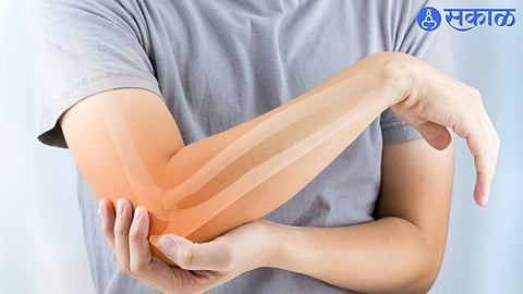 Bone Strengthening Foods