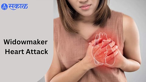 Widowmaker Heart Attack