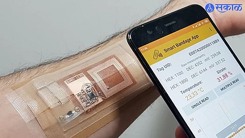 Smart Bandages