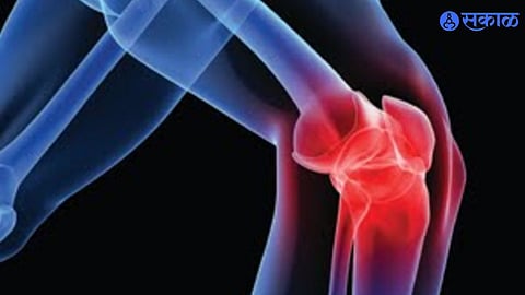 Food For Strong Bone