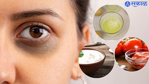 Dark Circles Removal Packs