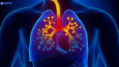 World Asthma Day 2022