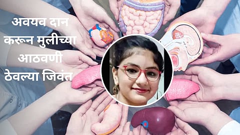 Organ Donation