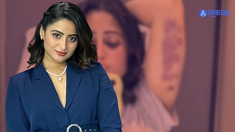 Aishwarya Sharma Gets Injured