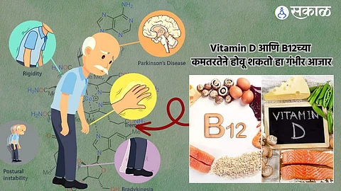 Importance of Vitamin D and B12