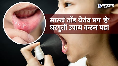 mouth ulcers home remedy