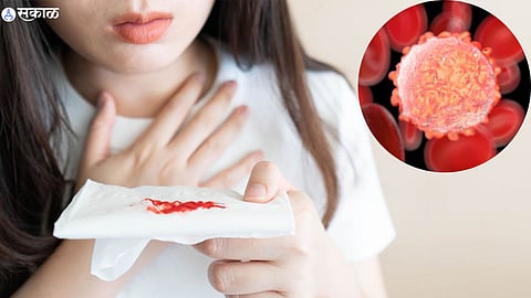 Symptoms Of Blood Cancer