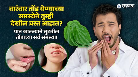 Mouth Ulcers Home Remedy