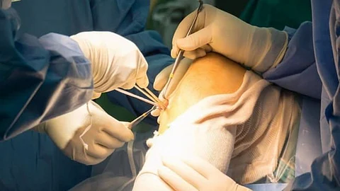 Knee Surgery