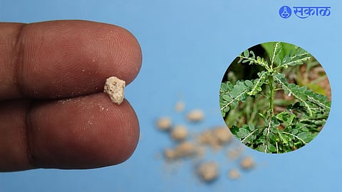 Kidney Stone Ayurvedic Treatment