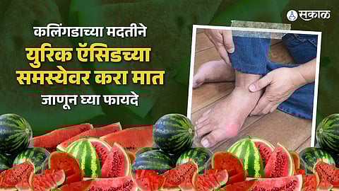 uric acid control diet