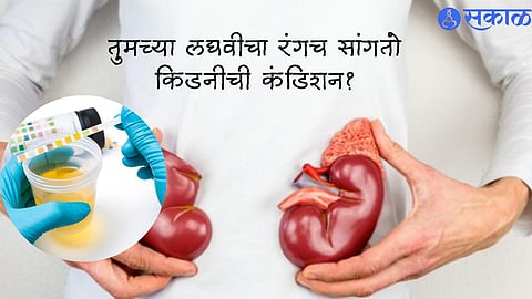 Damage Kidney Symptoms