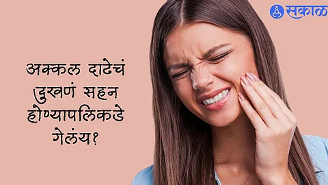 Wisdom Tooth Pain