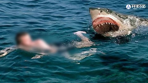 Shark Attack
