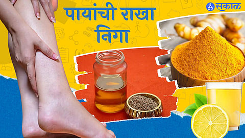 leg swelling reasons