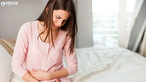 Signs Of PCOS