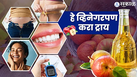 अॅपल सायडर व्हिनिगर