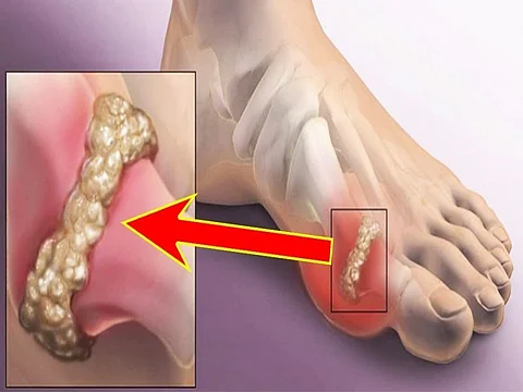 health news