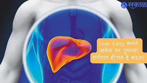Health Liver Tips