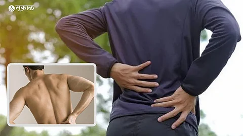 Back Pain In Men