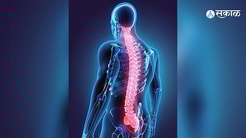 Spinal Cord Disorder