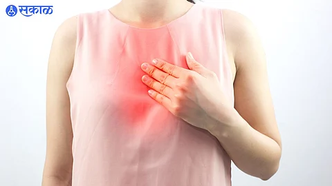 Heartburn Home Remedies