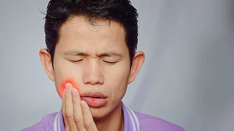 Mouth Ulcer