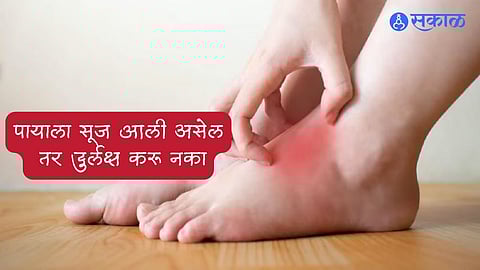 Blood Circulation Tips