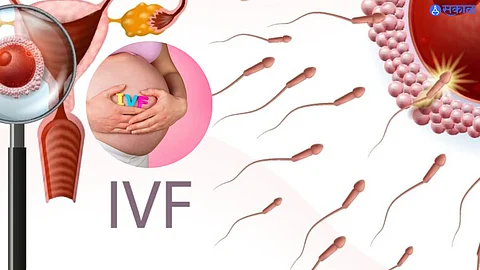 IVF Treatment