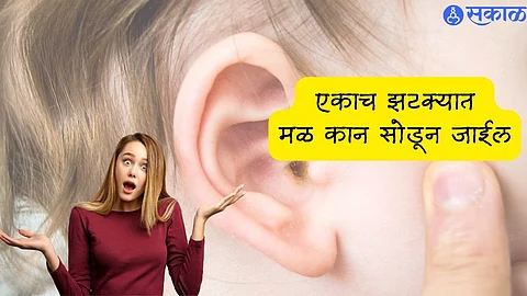 Remedies for Earwax