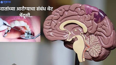 Dental Health