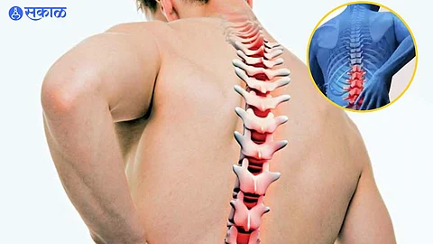 Mumbai Rise in Spinal Injury Complaints Various diseases due to pits bad road road accident traffic police