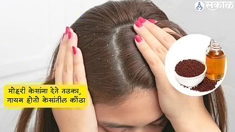 Mustard oil for Hair