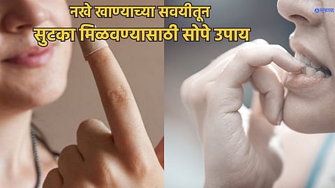 Nail Biting Side Effects