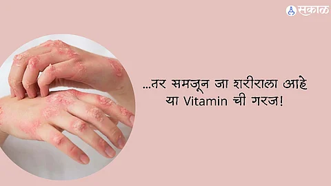 Vitamin For Skin