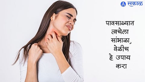 Monsoon Skin Care Tips