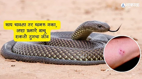 Snake Bite Remedies