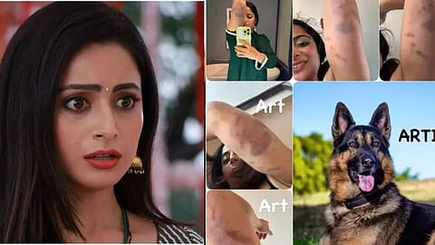 Khatron Ke Khiladi Season 13 Aishwarya Sharma Badly Injured Dog Attacked