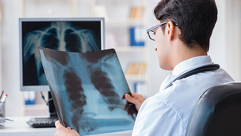 Lung Cancer