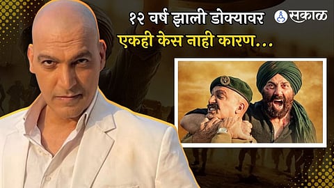 The villain of Gadar 2 manish wadhwa hasn't grown a single hair on his head for 12 years, here's a reason