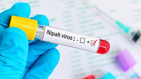 nipah virus