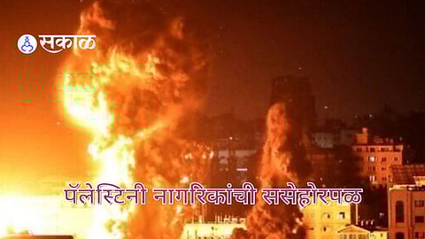 Israel-Hamas War: इस्राइलने गाझा पट्टीला भाजून काढले ; पॅलेस्टिनी नागरिकांची झाली ससेहोरपळ