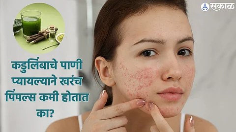 Neem Water For Skin