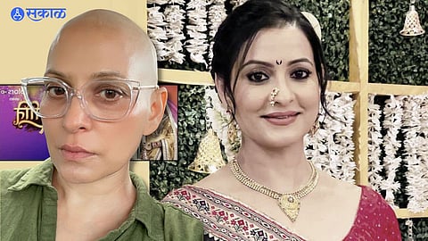 TV Actress Dolly Sohi Cancer: