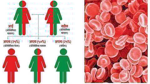 thalassemia