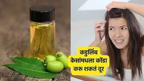 Hair Care Tips: कडुलिंब केसांमधला कोंडा करू शकतं दूर, असा करा वापर